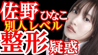 佐野ひなこ、顔の変化が話題に！「別人レベル」と驚きの声、整形疑惑も浮上